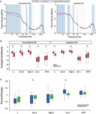 Movement-Modulation of Local Power and Phase Amplitude Coupling in Bilateral Globus Pallidus Interna in Parkinson Disease